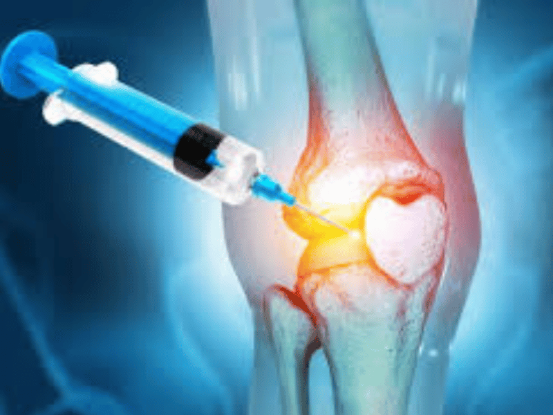 prp knee